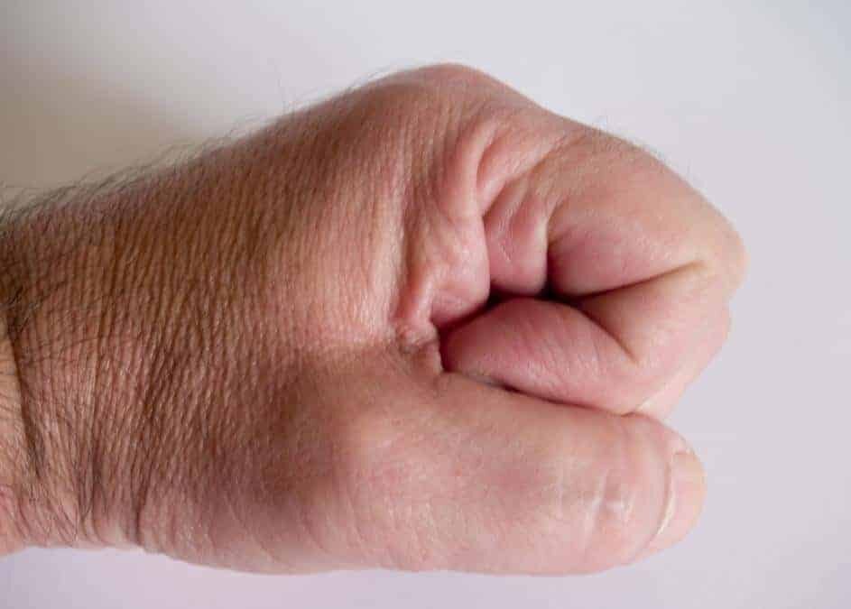 Image of a fist meant to represent anger